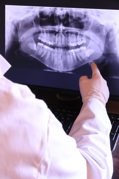 Best Emergency Root Canal Therapy in Stockbridge, MI