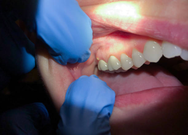 Best Weekend Emergency Dental Services in Stockbridge, MI