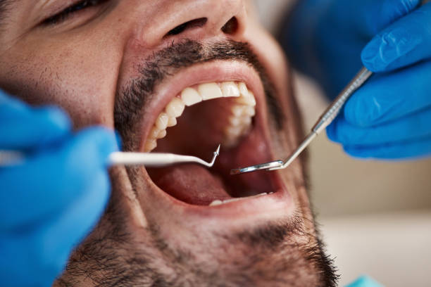 Best Emergency Root Canal Therapy in Stockbridge, MI
